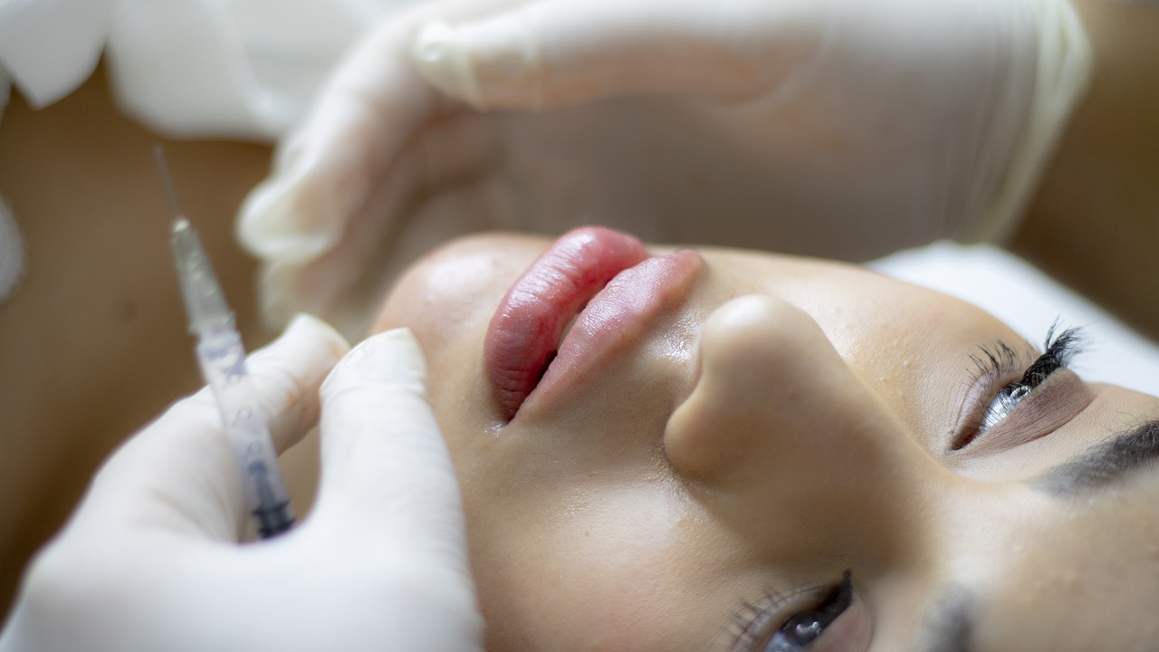 Smile Lines No More: Say Goodbye to Wrinkles with Dermal Fillers